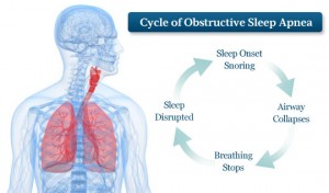 sleep apnea cycle